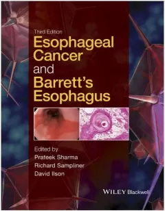 Esophageal Cancer and Barrett`s Esophagus