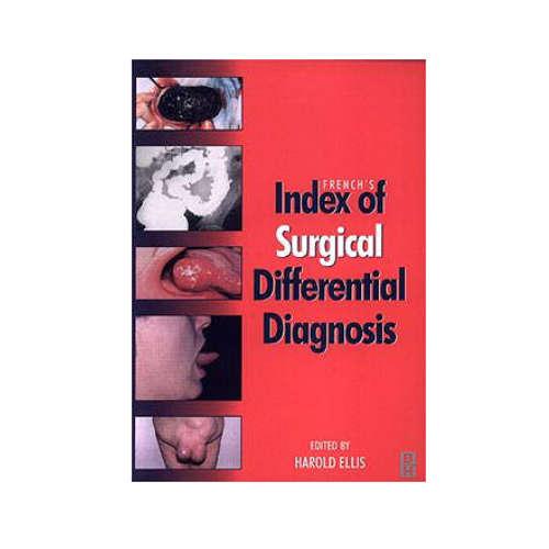 French`s Index of Surgical Differential Diagnosis