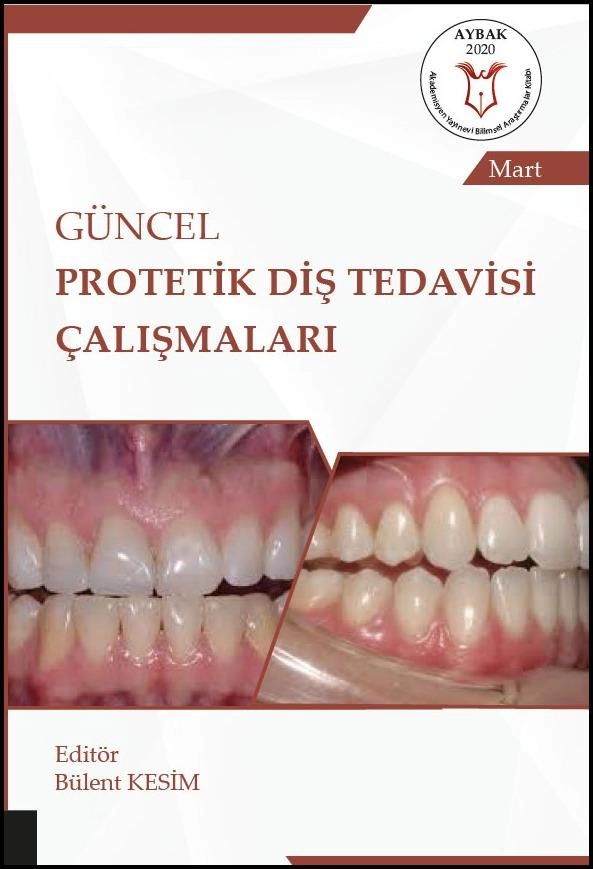 Güncel Protetik Diş Tedavisi Çalışmaları ( AYBAK 2020 Mart )