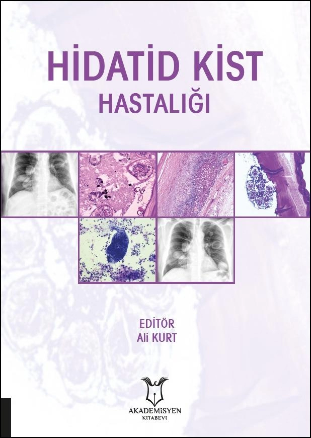 Hidatid Kist Hastalığı