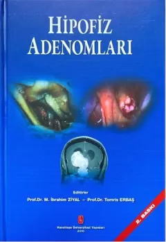 Hipofiz Adenomları