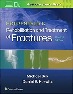 Hoppenfeld`s Treatment and Rehabilitation of Fractures