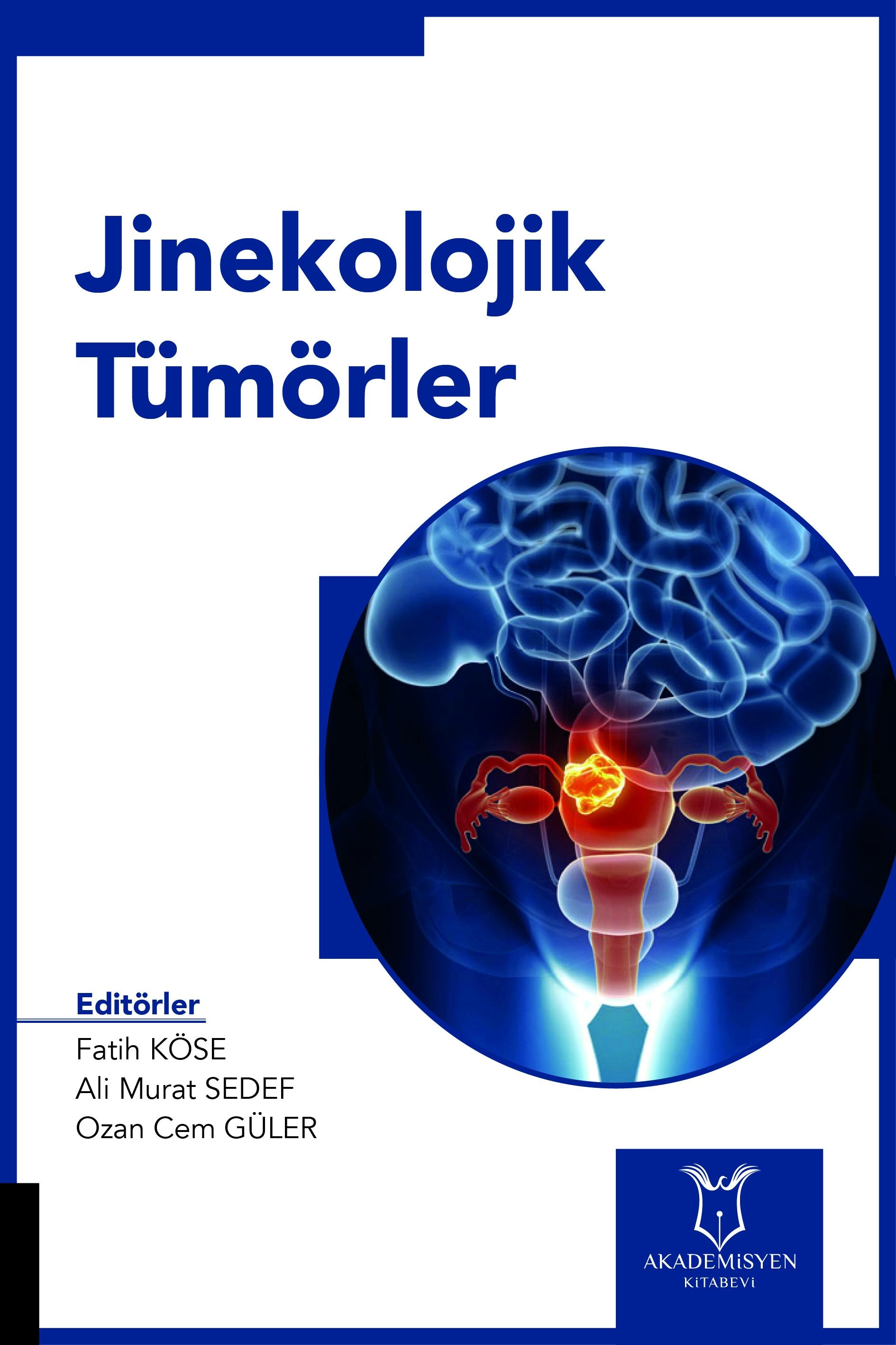 Jinekolojik Tümörler