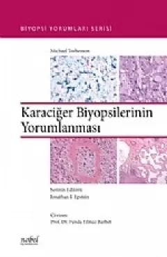 Karaciğer Biyopsilerinin Yorumlanması Biyopsi Yorumları Serisi