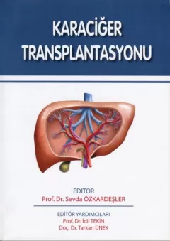 Karaciğer Transplantasyonu