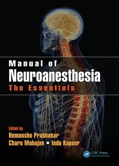 Manual of Neuroanesthesia: The Essentials