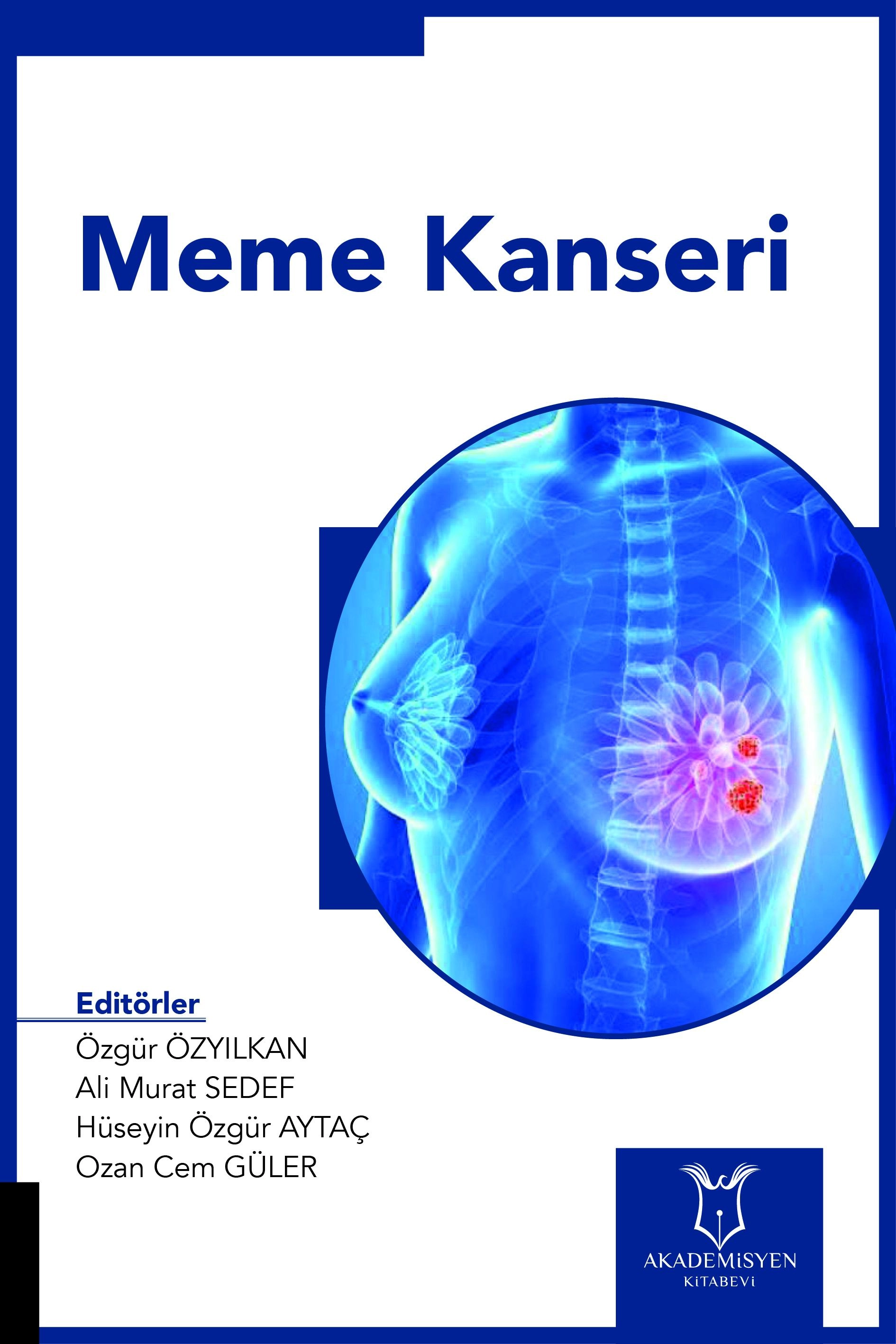 Meme Kanseri