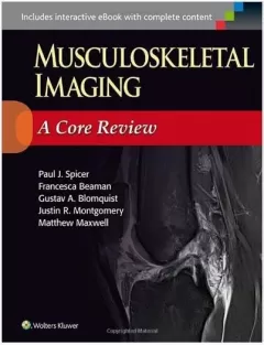 Musculoskeletal Imaging: A Core Review 