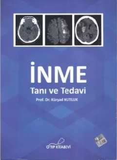 İnme Tanı ve Tedavi