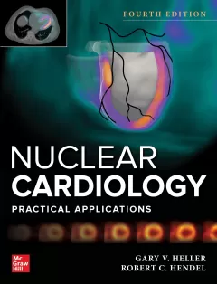 Nuclear Cardiology: Practical Applications, 4 Edition