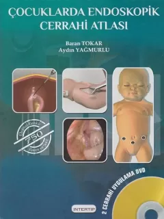 Çocuklarda Endoskopik Cerrahi Atlası