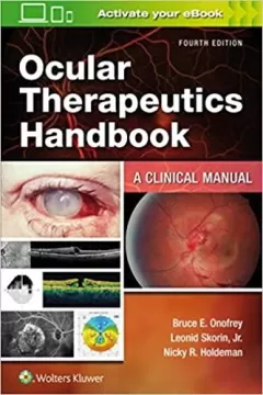Ocular Therapeutics Handbook: A Clinical Manual 4th