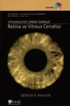 Oftalmolojide Cerrahi Teknikler Retina ve Vitreus Cerrahisi 