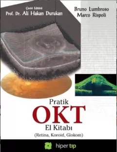 Pratik OKT El Kitabı (Retina, Koroid, Glokom)