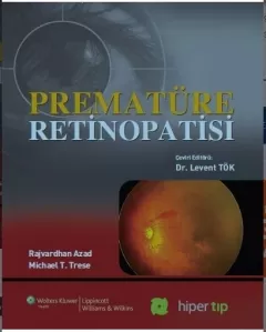 Prematüre Retinopatisi