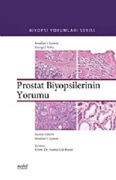 Prostat Biyopsilerinin Yorumu Biyopsi Yorumları Serisi