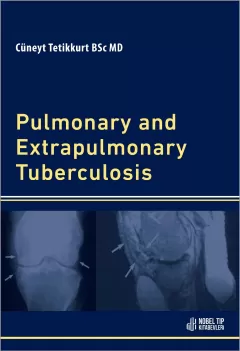 Pulmonary and Extrapulmonary Tuberculosis