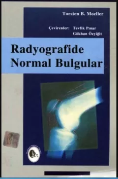 Radyografide Normal Bulgular