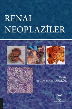 Renal Neoplaziler