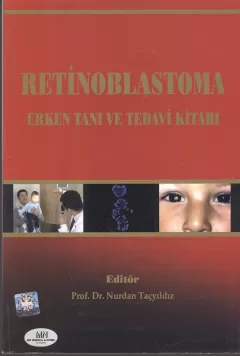 Retinoblastoma Erken Tanı Ve Tedavi Kitabı