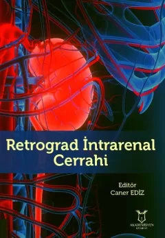 Retrograd İntrarenal Cerrahi
