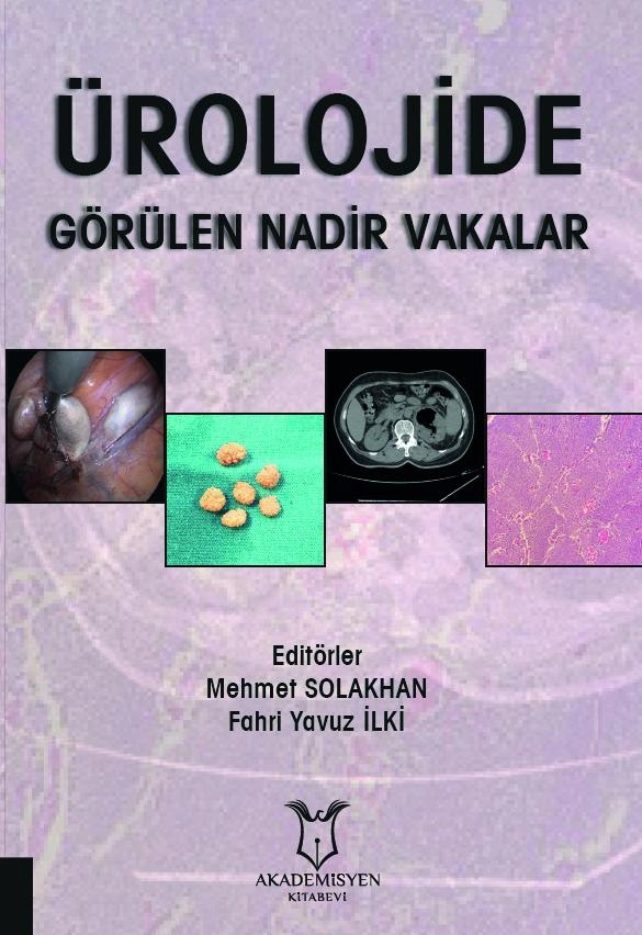 Ürolojide Görülen Nadir Vakalar