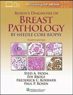 Rosen`s Diagnosis of Breast Pathology 