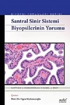 Santral Sinir Sistemi Biyopsilerinin Yorumu Biyopsi Yorumları Serisi