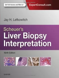 Scheuer`s Liver Biopsy Interpretation, 9th Edition