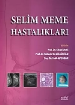 Selim Meme Hastalıkları