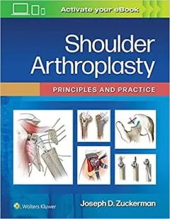 Shoulder Arthroplasty: Principles and Practice 