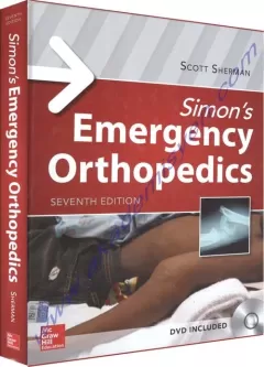 Simon`s Emergency Orthopedics