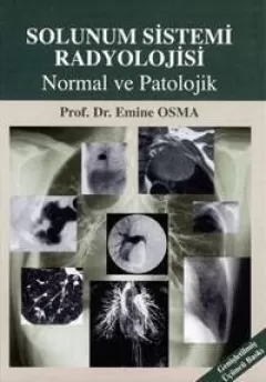 Solunum Sistemi Radyolojisi: Normal ve Patolojik