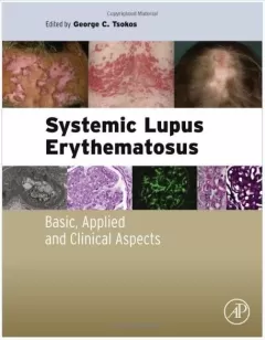 Systemic Lupus Erythematosus: Basic, Applied and Clinical Aspects 1st Edition