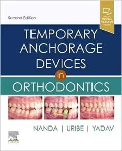 Temporary Anchorage Devices in Orthodontics