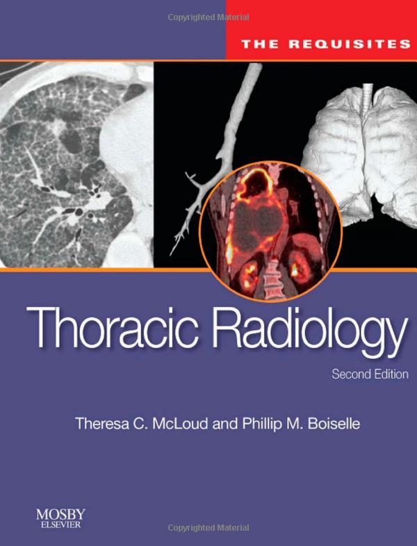The Requisites Thoracic Radiology