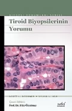 Tiroid Biyopsilerinin Yorumu Biyopsi Yorumları Serisi