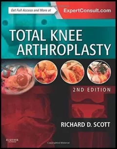 Total Knee Arthroplasty, 2e