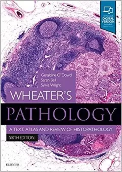 Wheater`s Pathology: A Text, Atlas and Review of Histopathology, 6th Edition