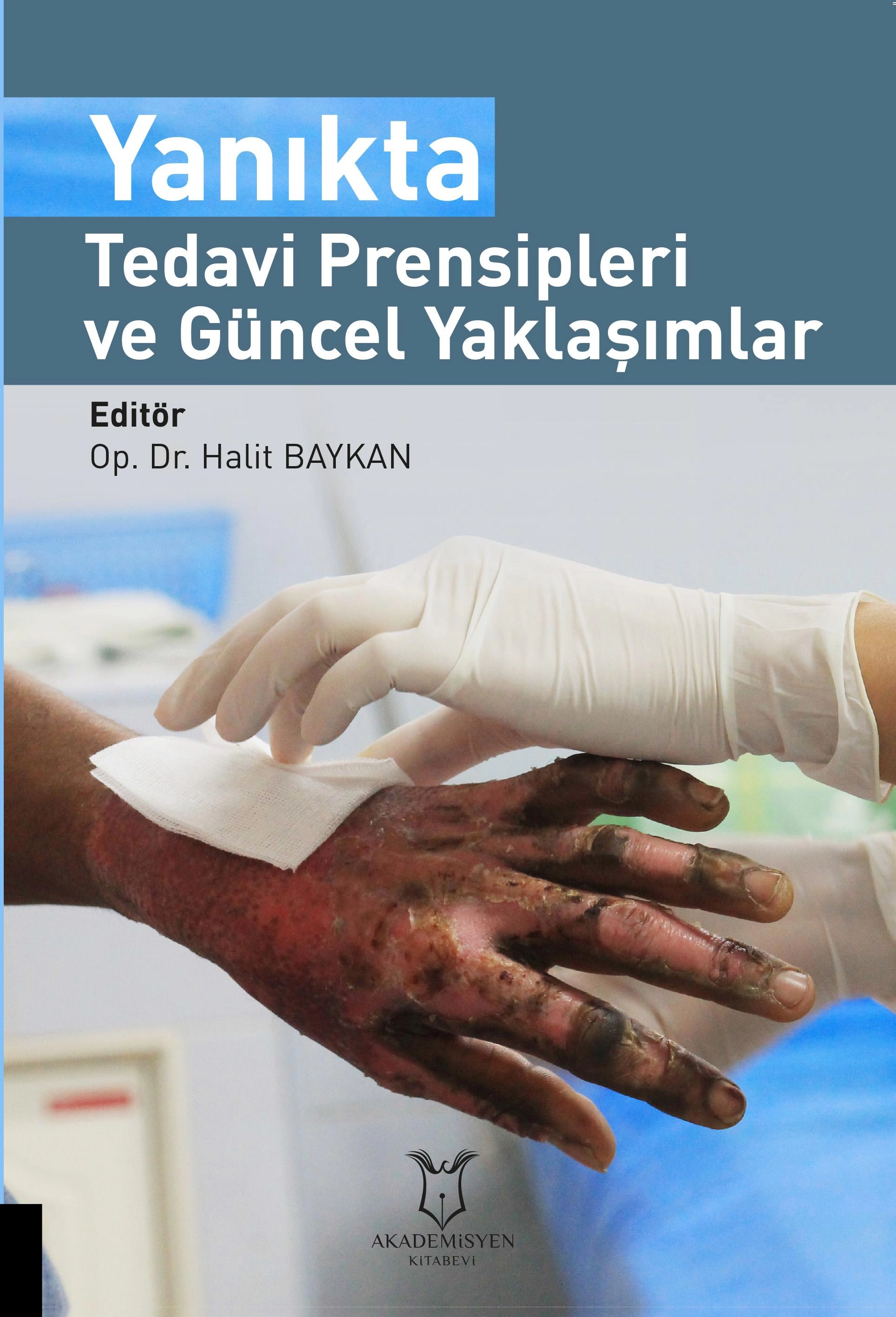 Yanıkta Tedavi Prensipleri ve Güncel Yaklaşımlar