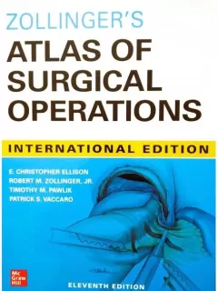 Zollinger`s Atlas of Surgical Operations