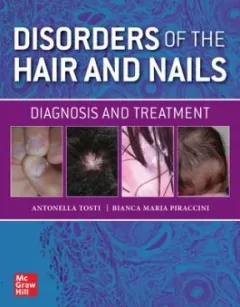 Disorders of the Hair and Nail: Diagnosis and Treatment