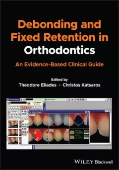 Debonding and Fixed Retention in Orthodontics: An Evidence-Based Clinical Guide