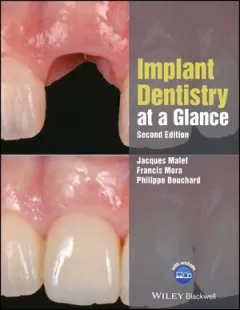 Implant Dentistry at a Glance, 2nd Edition