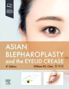 Asian Blepharoplasty and the Eyelid Crease, 4th Edition