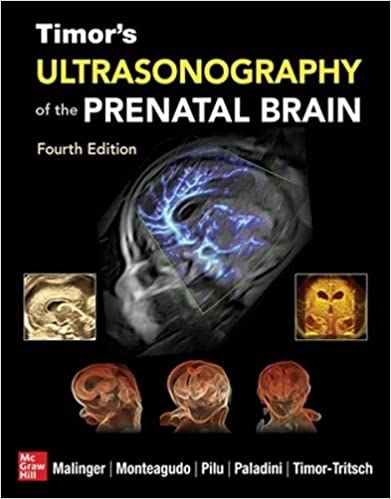 Timor's Ultrasonography of the Prenatal Brain, 4th Edition